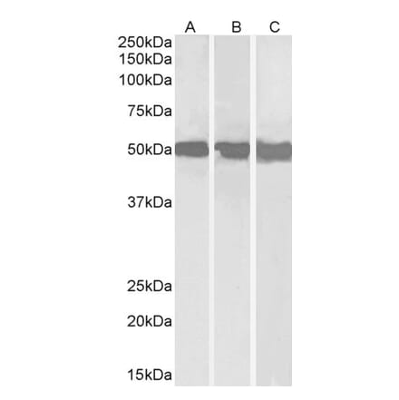 Western Blot - Anti-DDX6 Antibody (A84180) - Antibodies.com