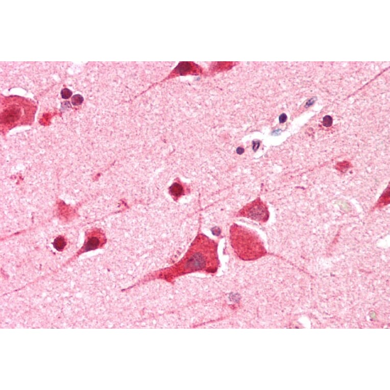 Immunohistochemistry - Anti-DDX6 Antibody (A84180) - Antibodies.com