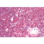 Immunohistochemistry - Anti-DDX6 Antibody (A84180) - Antibodies.com