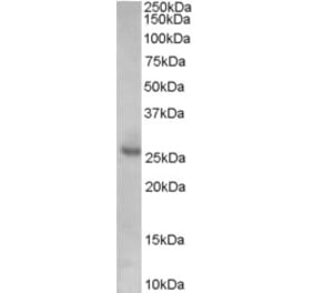 Western Blot - Anti-p27 KIP 1 Antibody (A84181) - Antibodies.com