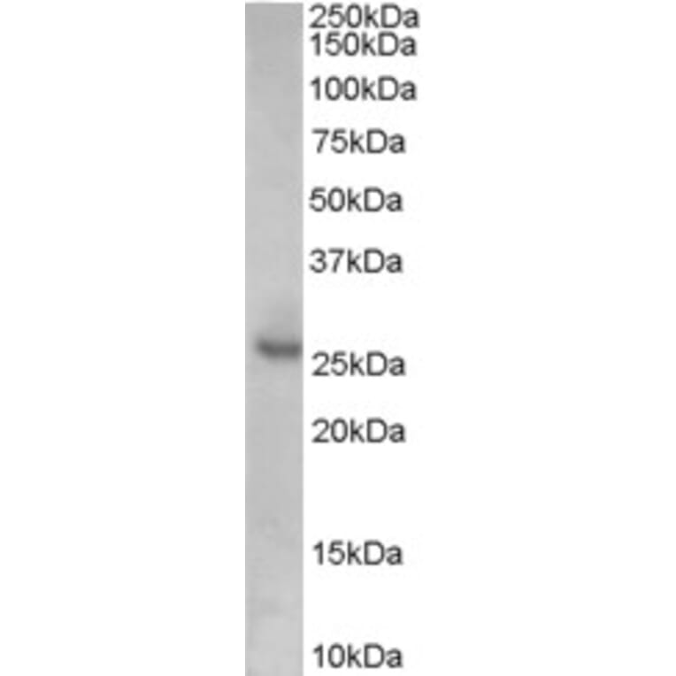 Western Blot - Anti-p27 KIP 1 Antibody (A84181) - Antibodies.com