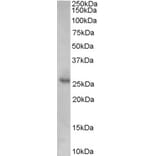 Western Blot - Anti-p27 KIP 1 Antibody (A84181) - Antibodies.com