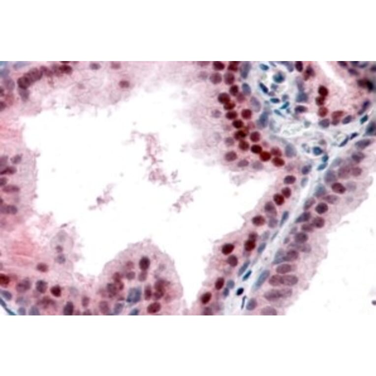 Immunohistochemistry - Anti-p27 KIP 1 Antibody (A84181) - Antibodies.com