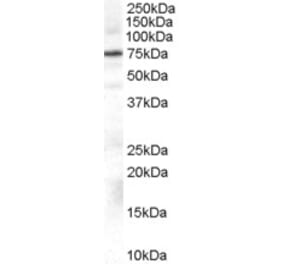 Western Blot - Anti-ADRBK1 Antibody (A84182) - Antibodies.com