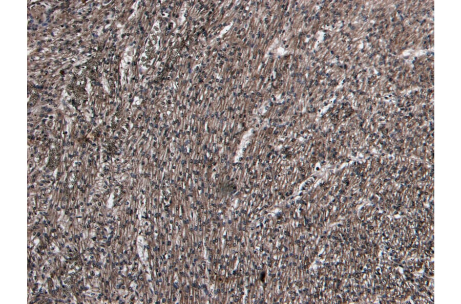 Immunohistochemistry - Anti-beta 1 Adrenergic Receptor Antibody (A84183) - Antibodies.com