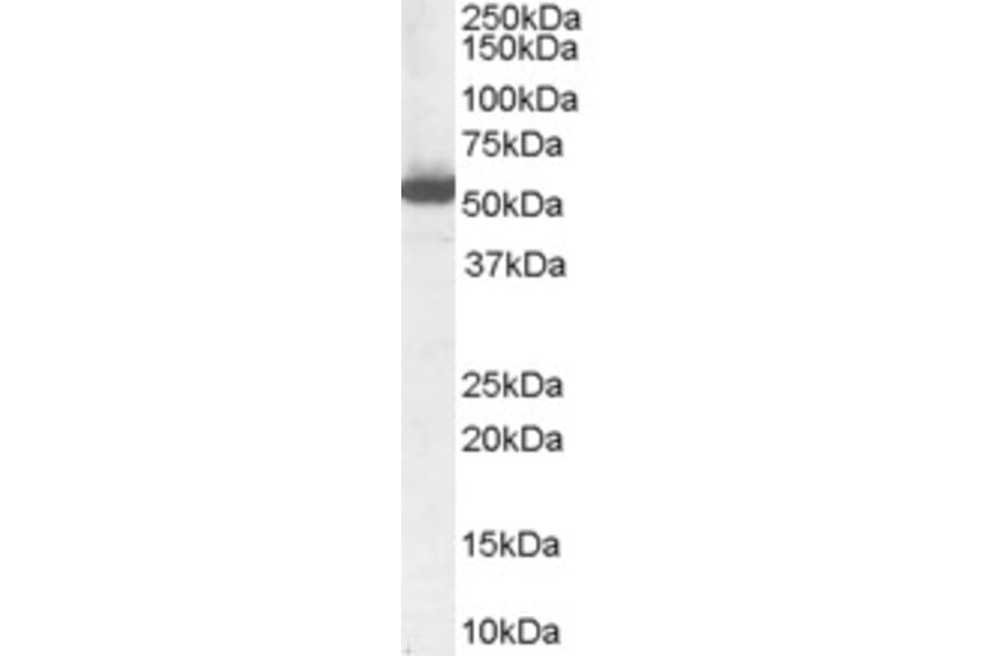 Western Blot - Anti-ALDH1A1 Antibody (A84184) - Antibodies.com