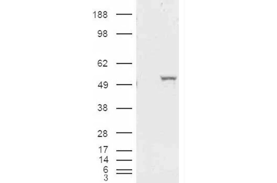 Western Blot - Anti-ALDH1A1 Antibody (A84184) - Antibodies.com