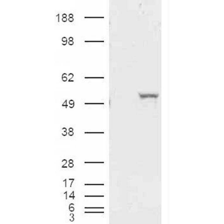 Western Blot - Anti-ALDH1A1 Antibody (A84184) - Antibodies.com