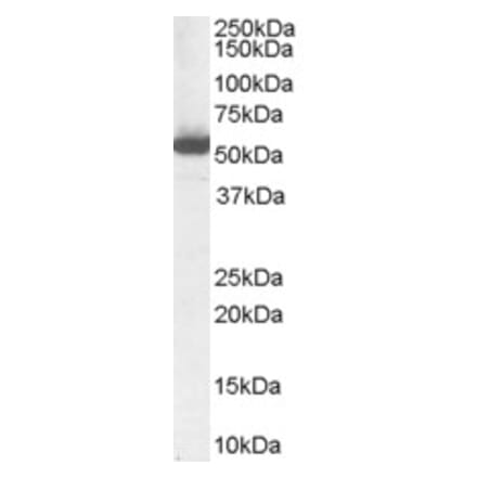 Western Blot - Anti-ALDH1A1 Antibody (A84184) - Antibodies.com
