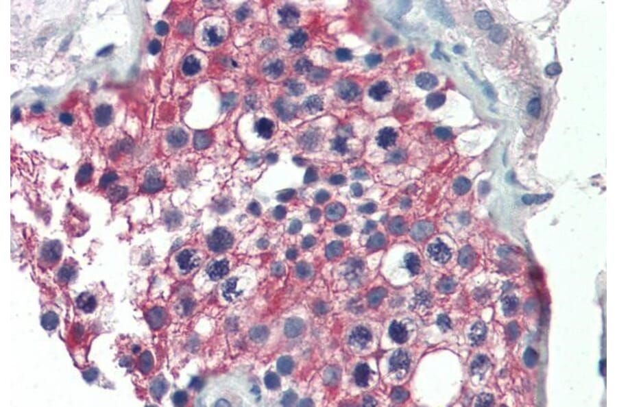 Immunohistochemistry - Anti-ALDH1A1 Antibody (A84184) - Antibodies.com