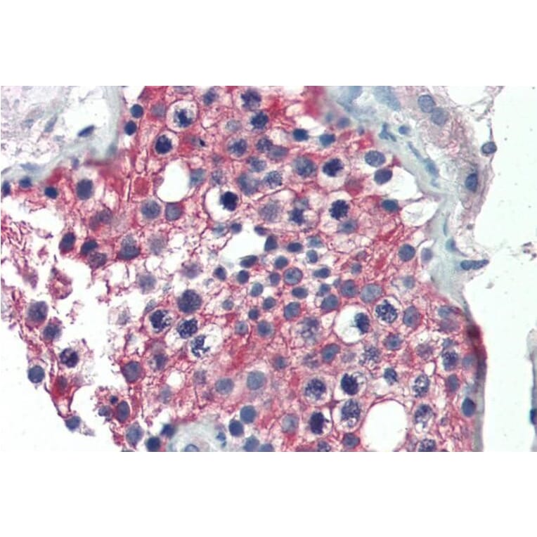 Immunohistochemistry - Anti-ALDH1A1 Antibody (A84184) - Antibodies.com