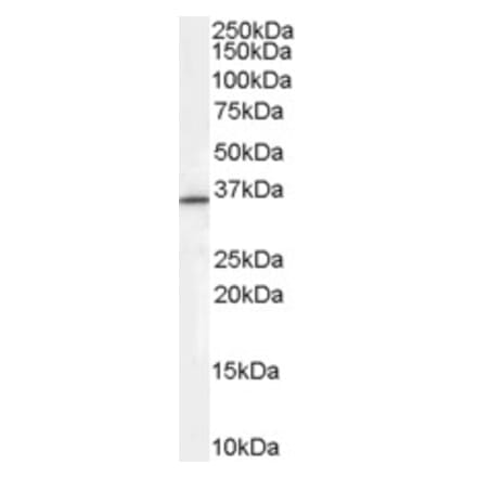 Western Blot - Anti-RNF115 Antibody (A84185) - Antibodies.com