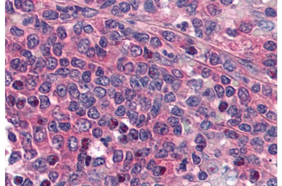 Immunohistochemistry - Anti-Prostaglandin E Receptor EP1/PTGER1 Antibody (A84186) - Antibodies.com