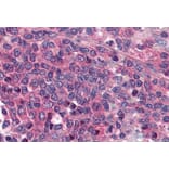 Immunohistochemistry - Anti-Prostaglandin E Receptor EP1/PTGER1 Antibody (A84186) - Antibodies.com