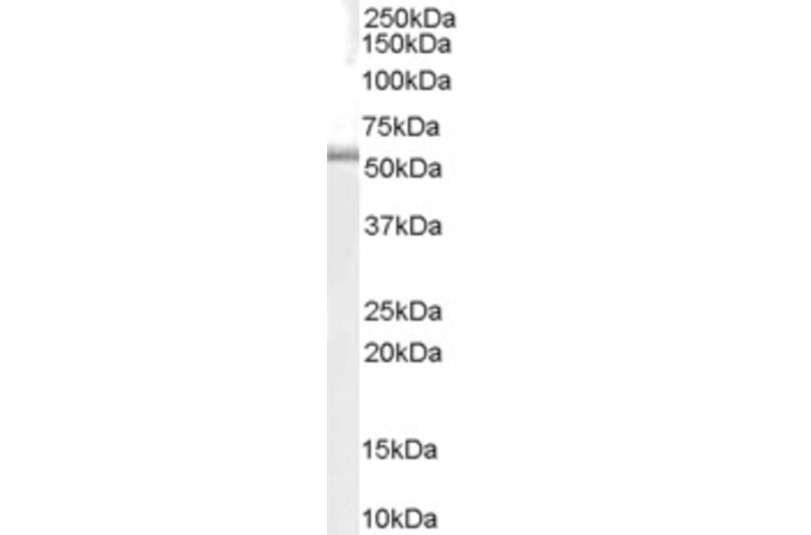 Western Blot - Anti-TRAF1 Antibody (A84189) - Antibodies.com