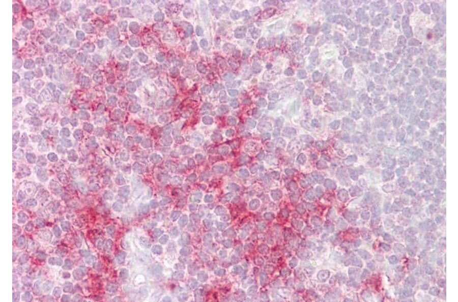 Immunohistochemistry - Anti-TRAF1 Antibody (A84189) - Antibodies.com