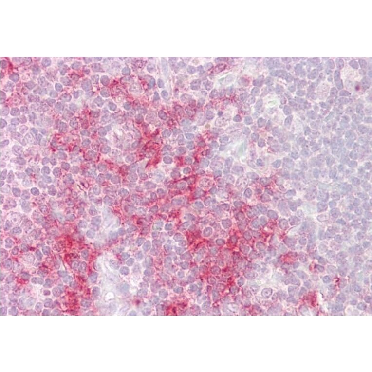 Immunohistochemistry - Anti-TRAF1 Antibody (A84189) - Antibodies.com