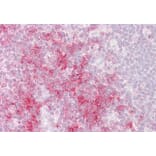 Immunohistochemistry - Anti-TRAF1 Antibody (A84189) - Antibodies.com