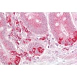 Immunohistochemistry - Anti-TRAF1 Antibody (A84189) - Antibodies.com