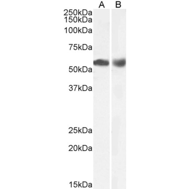 Western Blot - Anti-HDAC1 Antibody (A84192) - Antibodies.com