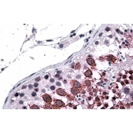 Immunohistochemistry - Anti-GALR3 Antibody (A84193) - Antibodies.com