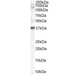 Western Blot - Anti-GALR3 Antibody (A84193) - Antibodies.com