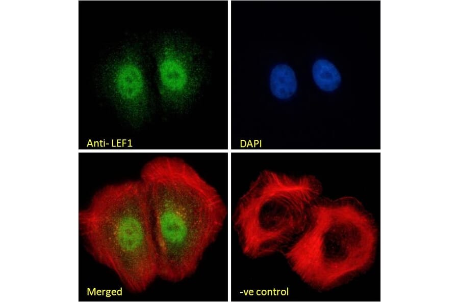Immunofluorescence - Anti-LEF1 Antibody (A84194) - Antibodies.com