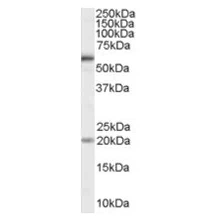 Western Blot - Anti-BMPR1A Antibody (A84195) - Antibodies.com