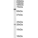 Western Blot - Anti-BMPR1A Antibody (A84195) - Antibodies.com