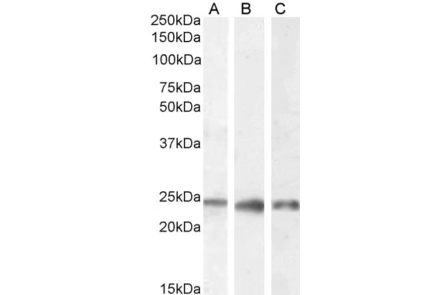 Western Blot - Anti-PGRMC1 Antibody (A84196) - Antibodies.com