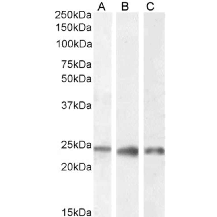 Western Blot - Anti-PGRMC1 Antibody (A84196) - Antibodies.com