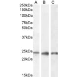 Western Blot - Anti-PGRMC1 Antibody (A84196) - Antibodies.com