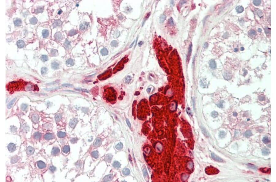 Immunohistochemistry - Anti-PGRMC1 Antibody (A84196) - Antibodies.com