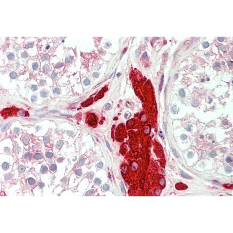 Immunohistochemistry - Anti-PGRMC1 Antibody (A84196) - Antibodies.com