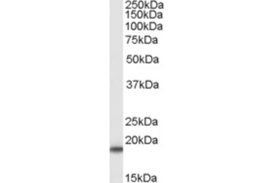 Western Blot - Anti-Superoxide Dismutase 1 Antibody (A84197) - Antibodies.com