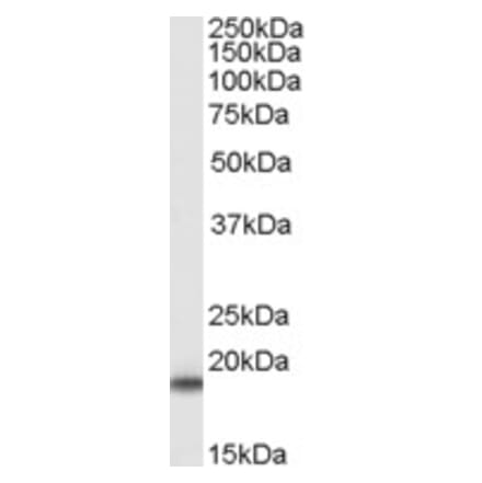 Western Blot - Anti-Superoxide Dismutase 1 Antibody (A84197) - Antibodies.com