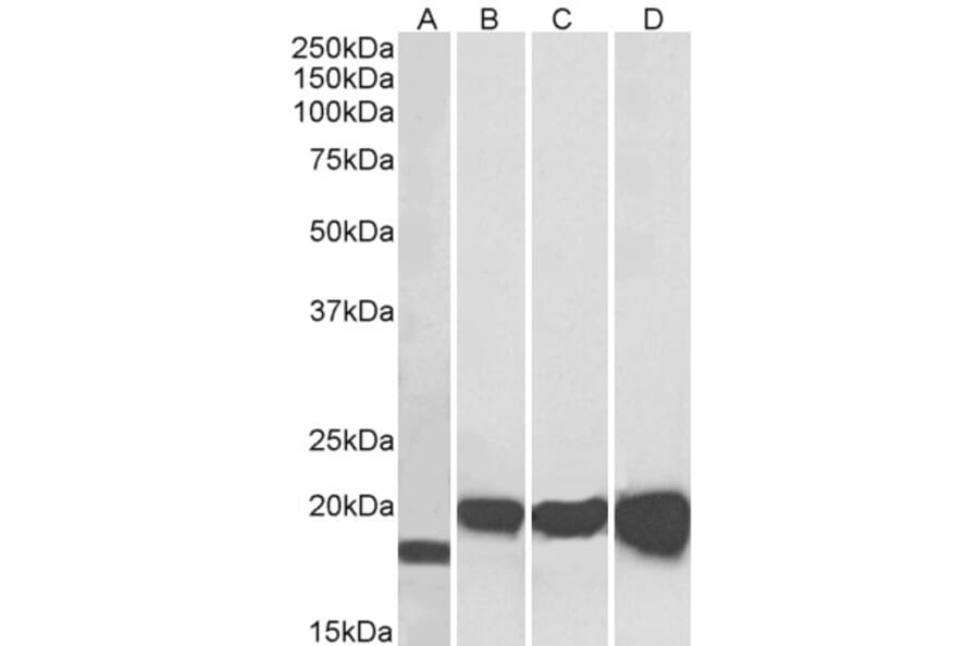 Western Blot - Anti-Superoxide Dismutase 1 Antibody (A84197) - Antibodies.com