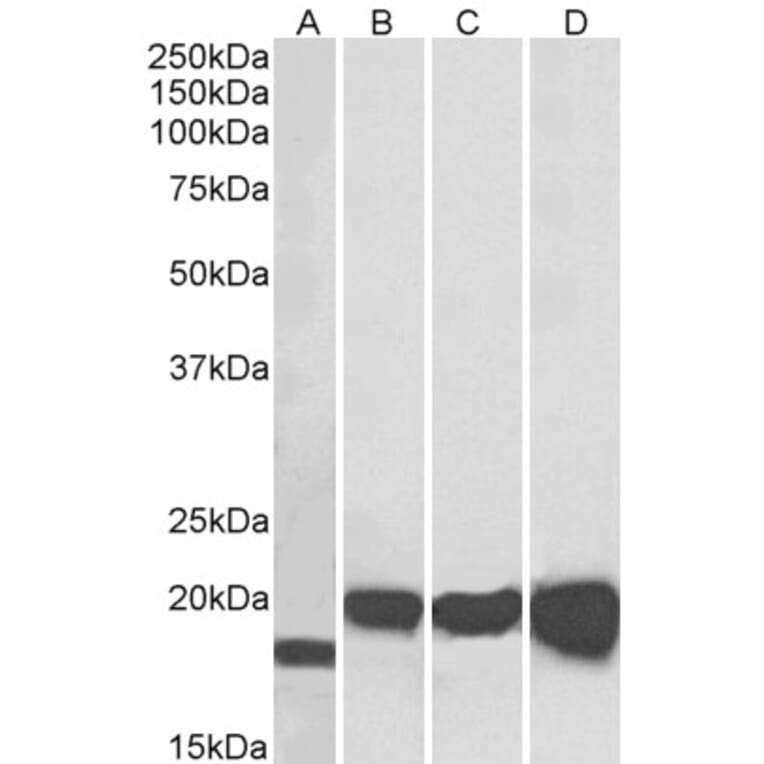 Western Blot - Anti-Superoxide Dismutase 1 Antibody (A84197) - Antibodies.com