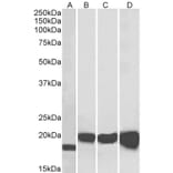 Western Blot - Anti-Superoxide Dismutase 1 Antibody (A84197) - Antibodies.com