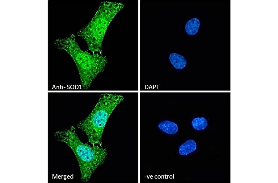 Immunofluorescence - Anti-Superoxide Dismutase 1 Antibody (A84197) - Antibodies.com