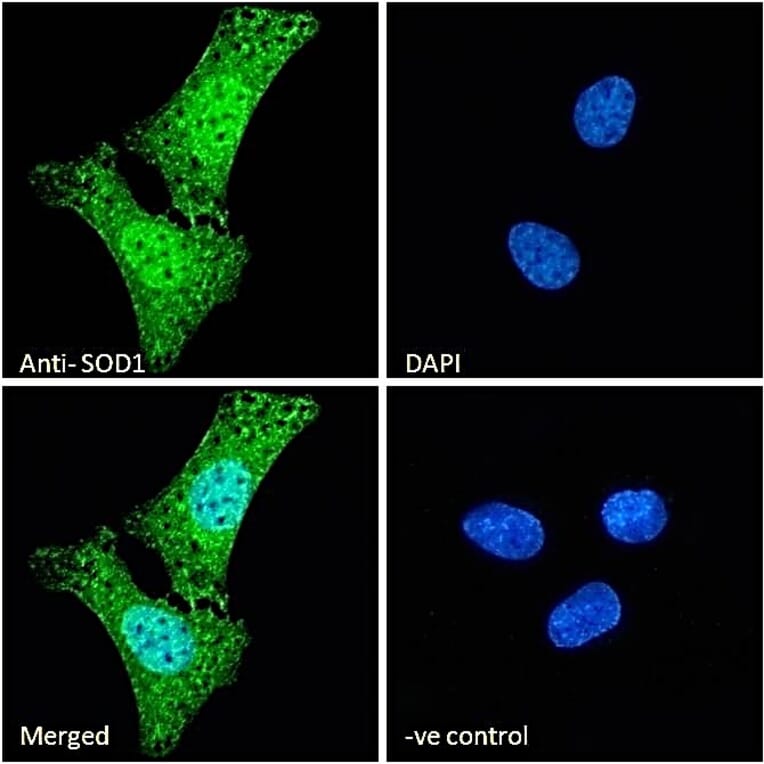 Immunofluorescence - Anti-Superoxide Dismutase 1 Antibody (A84197) - Antibodies.com