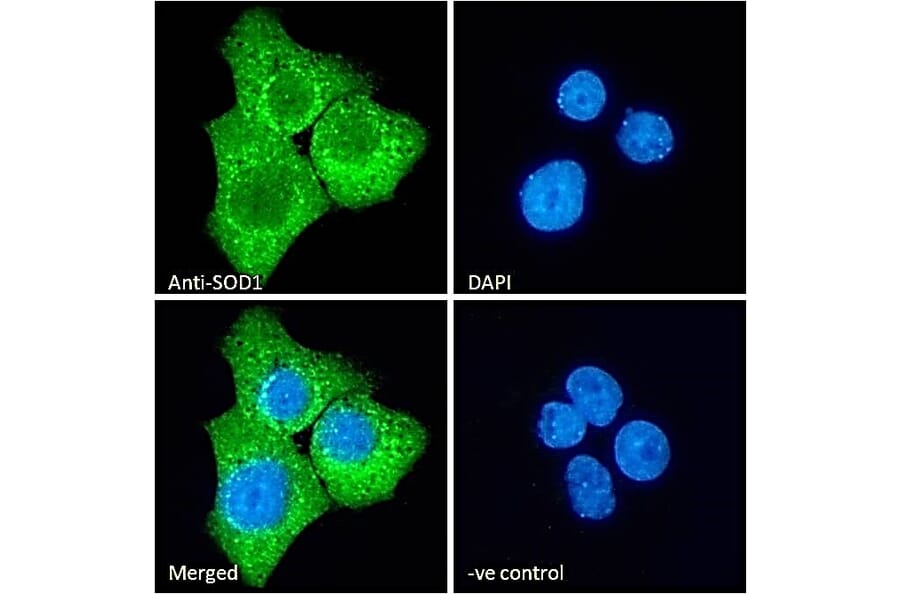 Immunofluorescence - Anti-Superoxide Dismutase 1 Antibody (A84197) - Antibodies.com