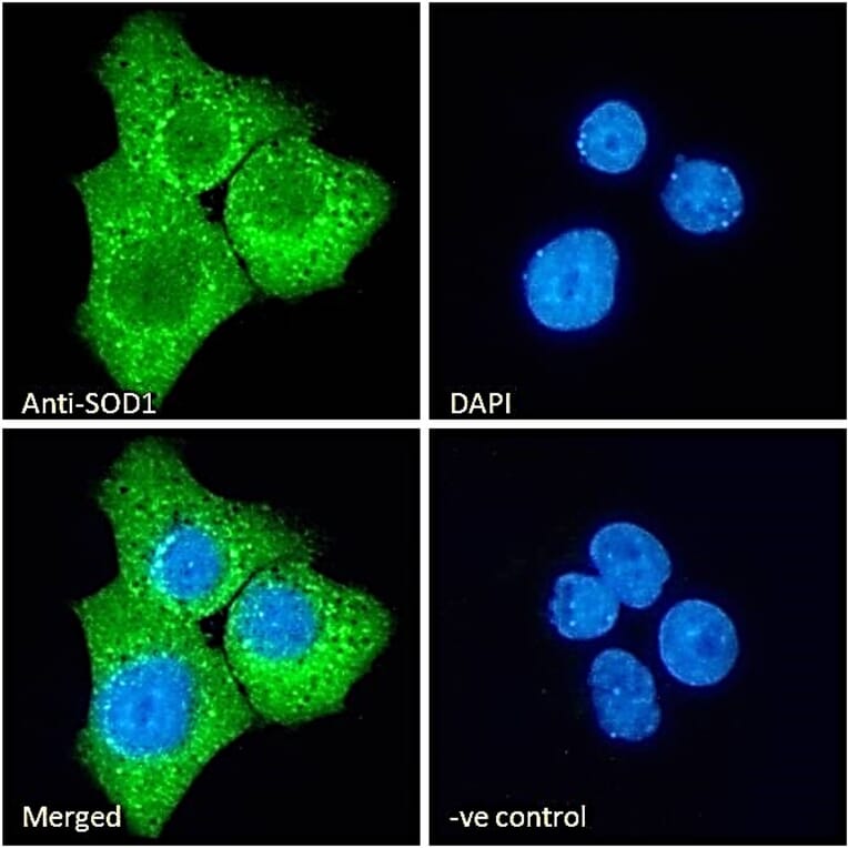 Immunofluorescence - Anti-Superoxide Dismutase 1 Antibody (A84197) - Antibodies.com