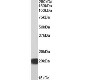 Western Blot - Anti-SOD1 Antibody (A84198) - Antibodies.com
