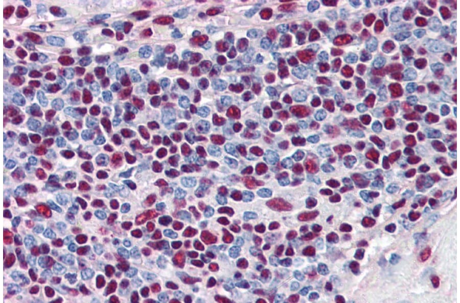 Immunohistochemistry - Anti-Ku80 Antibody (A84199) - Antibodies.com