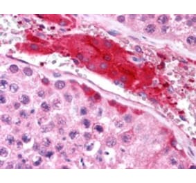 Immunohistochemistry - Anti-HGS Antibody (A84200) - Antibodies.com