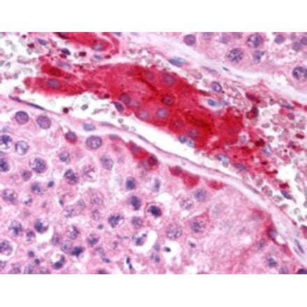 Immunohistochemistry - Anti-HGS Antibody (A84200) - Antibodies.com