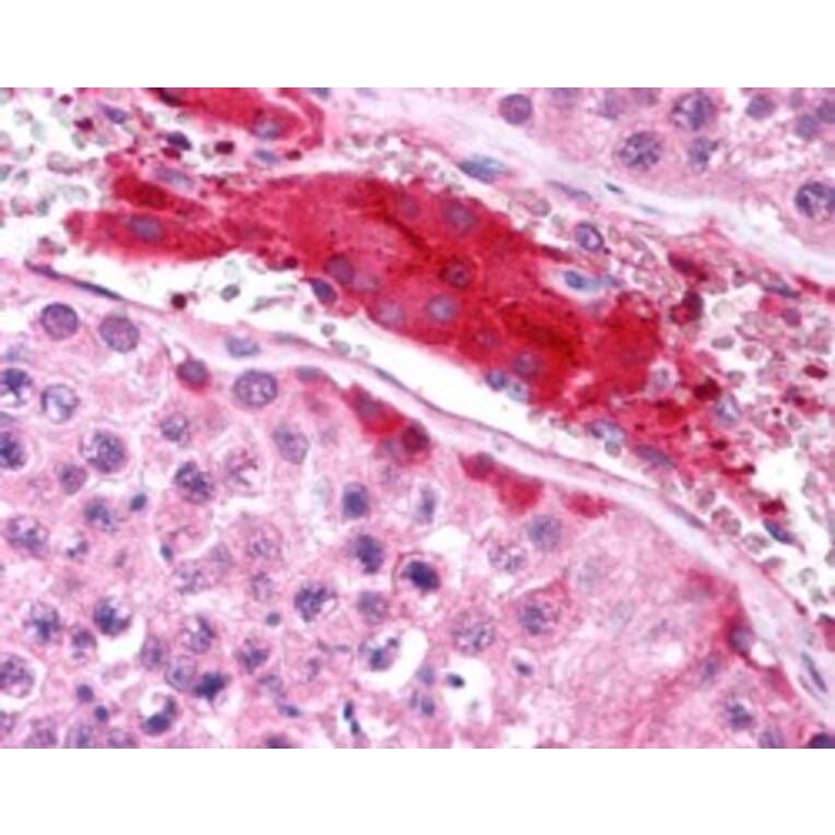 Immunohistochemistry - Anti-HGS Antibody (A84200) - Antibodies.com