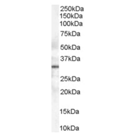 Western Blot - Anti-STX6 Antibody (A84201) - Antibodies.com