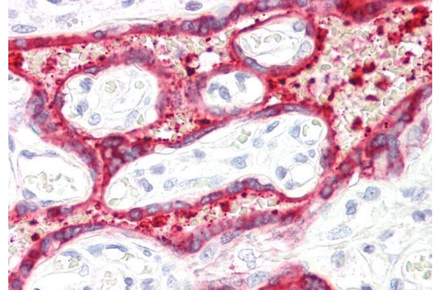 Immunohistochemistry - Anti-HSD3B1 Antibody (A84203) - Antibodies.com
